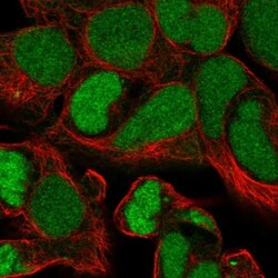 ZSCAN16 Antibody, Novus Biologicals 0.1mL; Unlabeled:Antibodies, Polyclonal